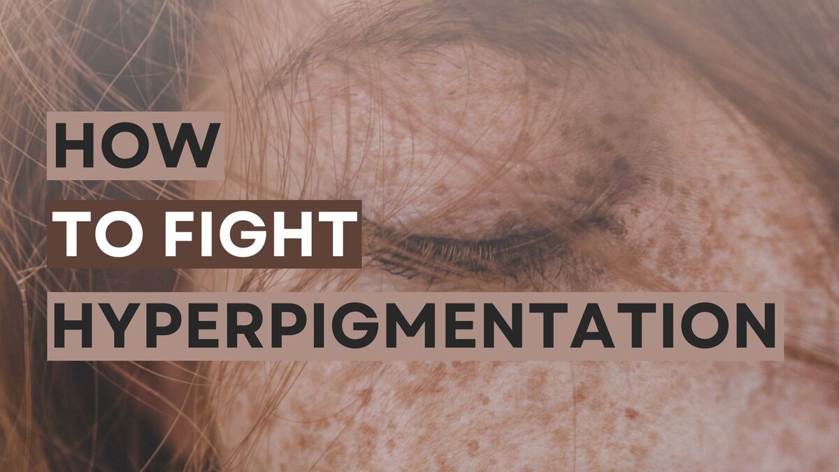 How To Fight Hyperpigmentation