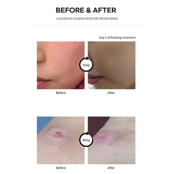 La Chomb ] LA BLANCHE Cream 60ml | BeautyStarAlliance